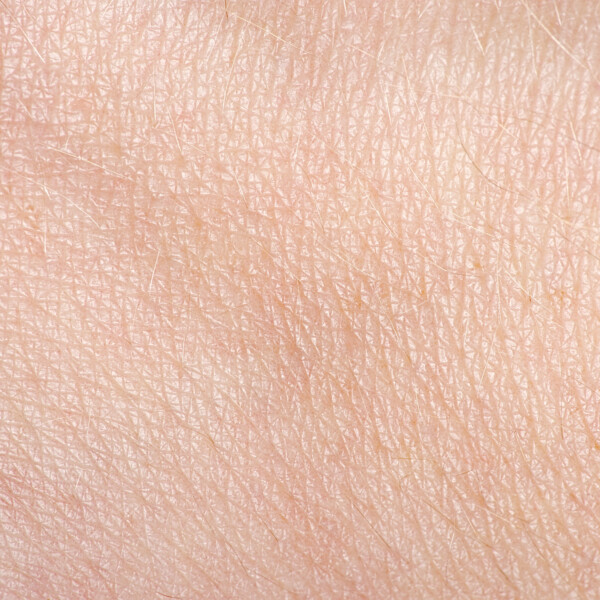 Detailed close-up of skin texture, representative of the dermatological focus in skin lupus studies