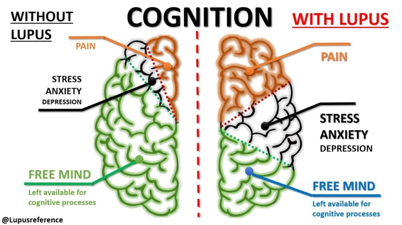 Image for the Tweet beginning: ✅ If you have #lupus,