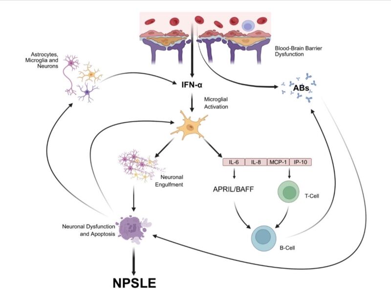 Image for the Tweet beginning: Could #anifrolumab be a game-changer
